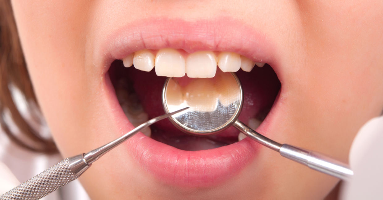 用芦荟汁冲洗可以防止牙菌斑。