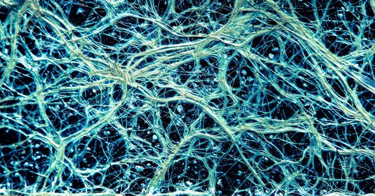 植物中的细血管根网络。
